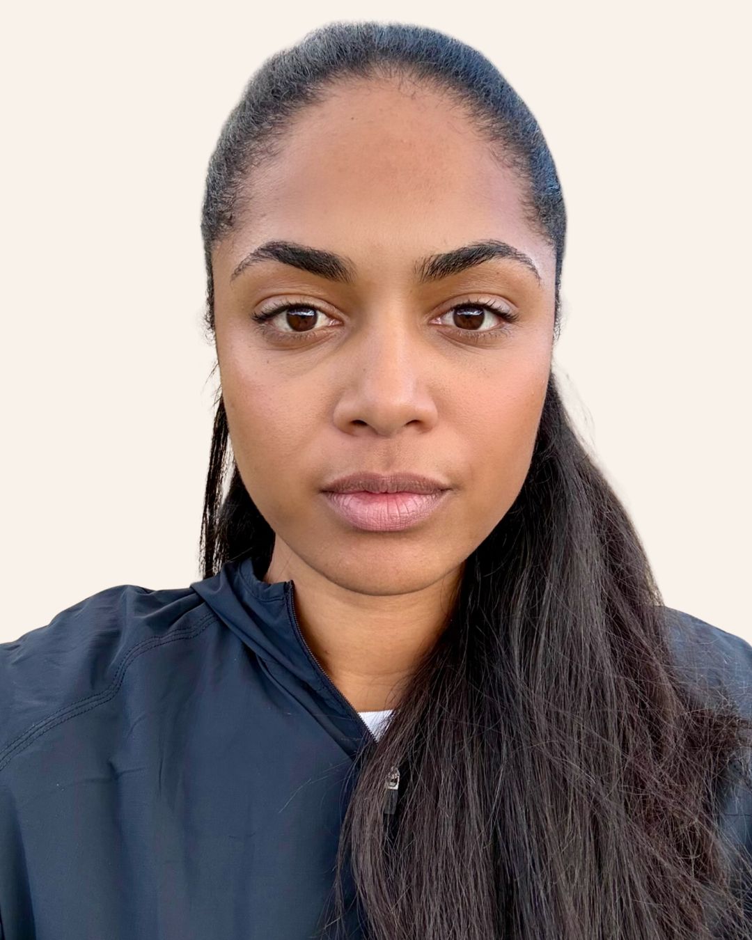 After — Rejuran Skin Healer Therapy at The Refined Co