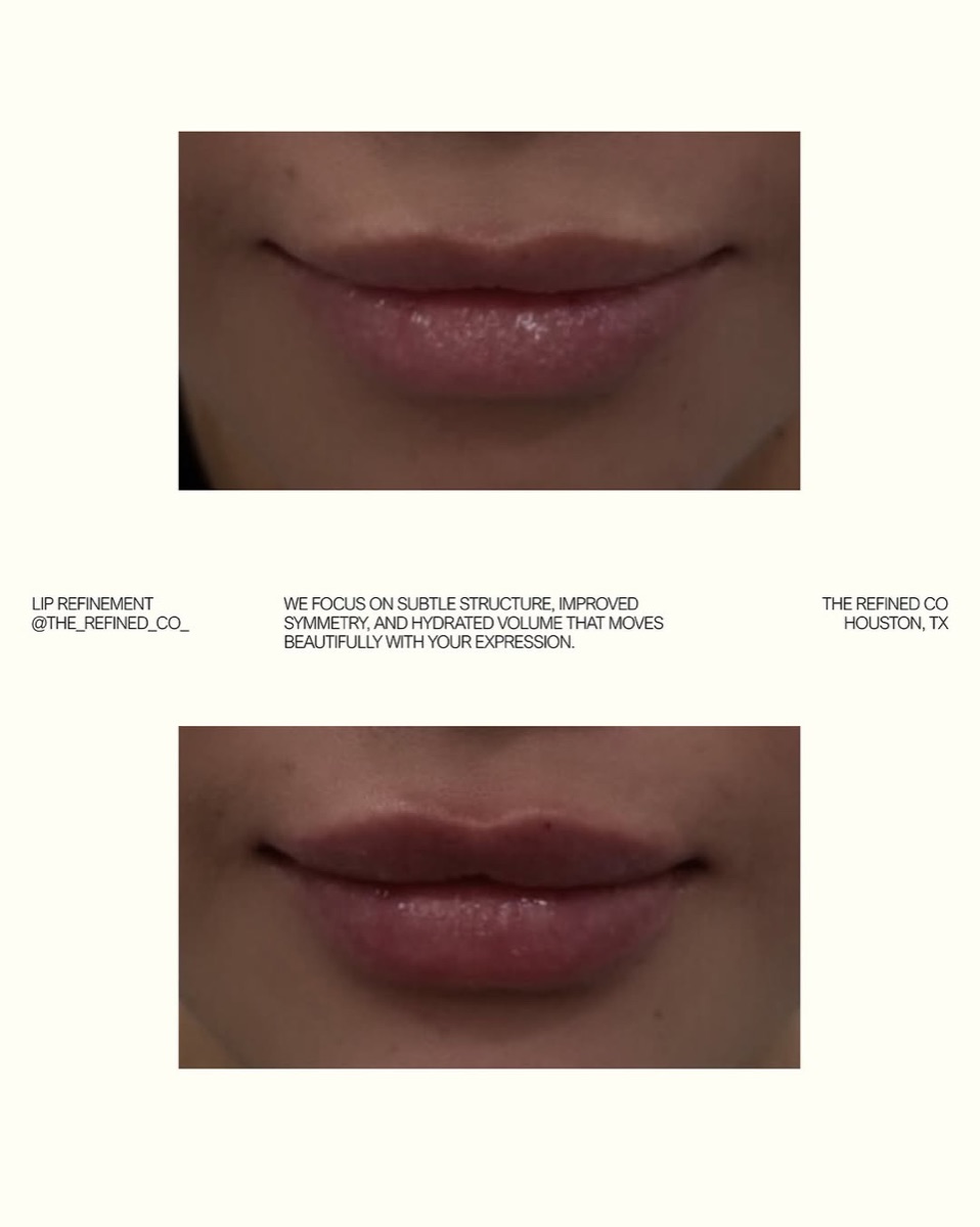 Lip refinement at The Refined Co
